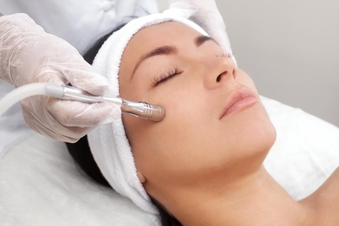 A Simple Guide to Microdermabrasion Treatments
